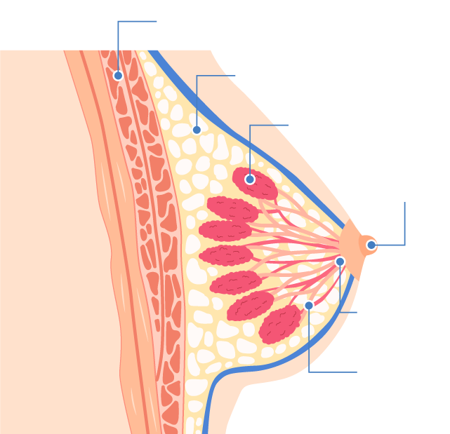 乳癌是什麼?